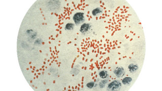 Още един човек почина от чума в северната част на Китай