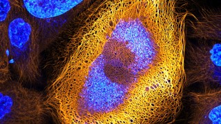 Българско лекарство разработка на учени от БАН спасява кожата от