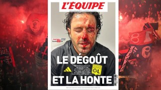Инцидентът преди дербито между Марсилия и Лион шокира френската общественост