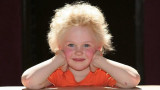 Синдром на несресваемата коса при децата и причинитеза това нетипично състояние