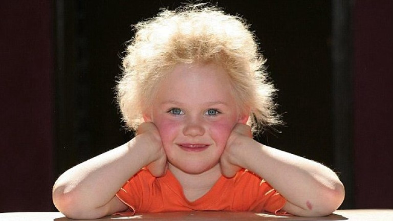 Има ли спасение от синдрома на несресваемата коса при децата