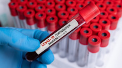 6630 нови случая на коронавирус, близо 25% от тестовете са положителни