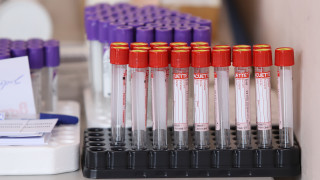 97% от донорите на кръв в Нидерландия имат антитела срещу коронавируса