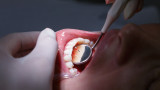 Българин изобрети апарат за дистанционни стоматологични прегледи