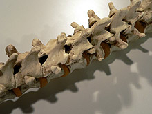 Преглеждат ученици за гръбначни изкривявания в Силистра