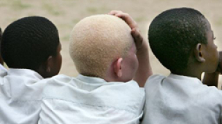 8 смъртни присъди в Танзания заради убийства на албиноси