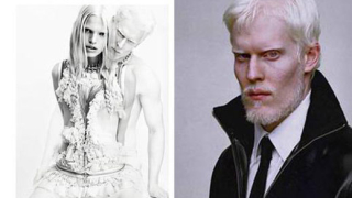 Модел-албинос се появи в новата кампания на Givenchy