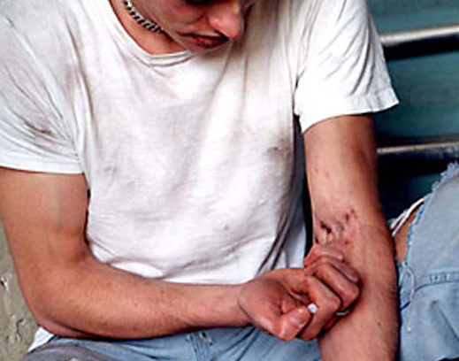 Нови практики в лечението на хероинова зависимост