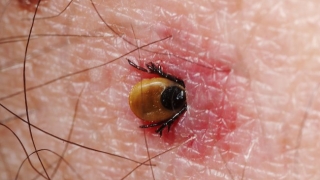 Според Националния център по заразни и паразитни болести НЦЗПБ