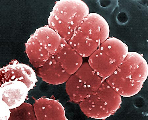 Откриха най-простите микроби на Земята