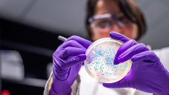 Ешерихия коли - какво трябва да знаем за бактерията и как да се предпазим