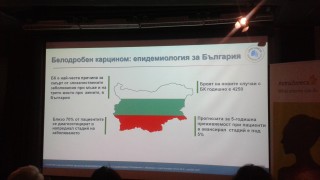 Ракът на белия дроб е причина номер едно за смърт при българските мъже