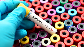 Антраксът е остро инфекциозно заболяване чийто причинител е Bacillus anthracis