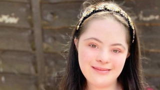 Първото рекламно лице на Gucci със синдром на Даун