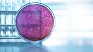 Бактерии в ролята на батерии