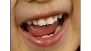 Момиче се смее в продължение на 12 г.