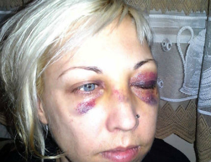 Жена твърди, че е жертва на полицейско насилие, МВР проверява 