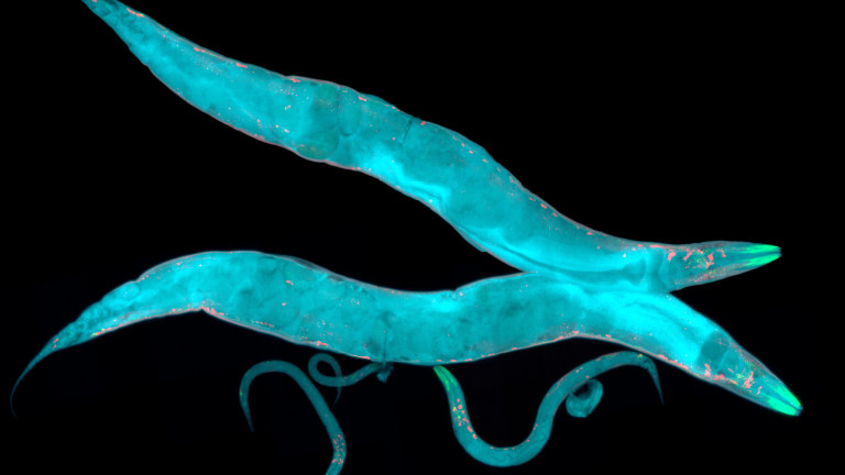  Снимка на кръгли червеи под микроскоп 