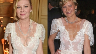 И Кирстен Дънст легна под скалпела