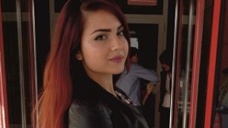 Успешна операция от редкия Синдром на лешникотрошачката бе извършена в