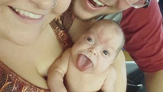 Бебе с език като на възрастен, най-накрая се усмихва (СНИМКИ)