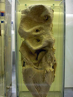 40 арестувани за търговия с органи в Турция