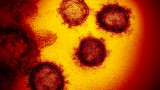 Взривообразно: 4041 нови случая на коронавирус, 63 жертви 