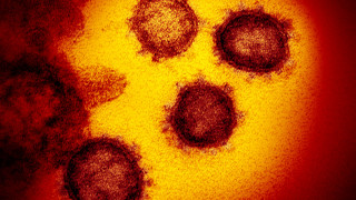 1803 нови случая на коронавирус при 7259 теста