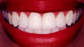 Цитрусите и хапчетата Антибебе вредни за зъбите 