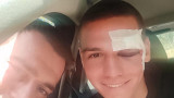 Антов със затворено око след сблъсъка с Хоган 