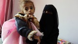 85 000 деца може да са умрели от апетит в Йемен 