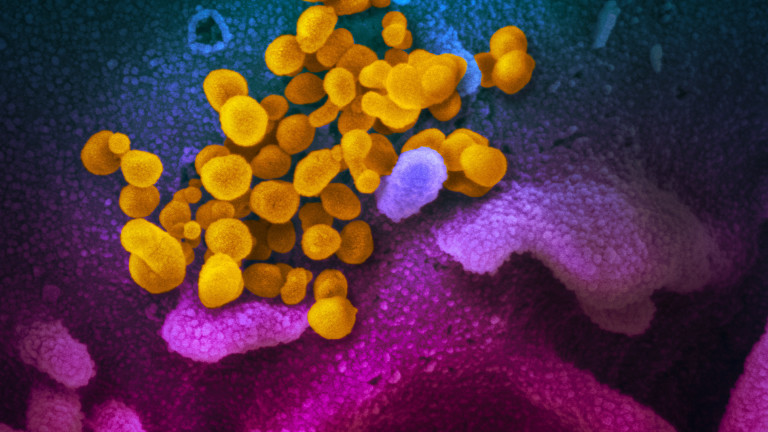 Как изглежда новият коронавирус под микроскоп