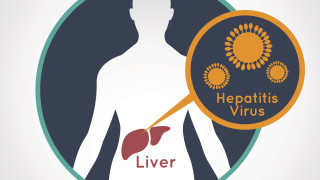 Неизвестен тежък щам на хепатит е идентифициран при близо 170