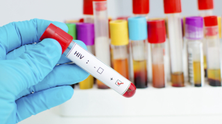 С 230 души са се увеличили заразените с ХИВ хора