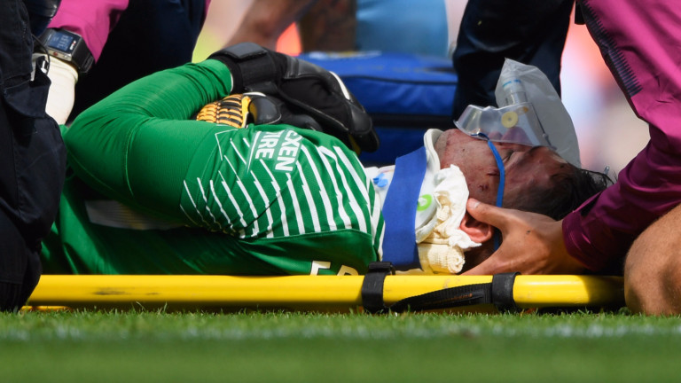 Едерсон показа страховитите си белези (СНИМКА)