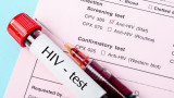  Откриха нов, по-агресивен вид на ХИВ в Нидерландия 