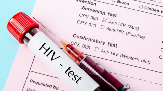 Откриха нов, по-агресивен вариант на ХИВ в Нидерландия