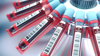 След констатирани нарушения ще отнемат лиценза на банката за стволови