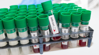 В много отношения това e напълно логично Пациентите с тежка