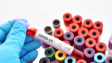 117 достигнаха случаите с коронавирус в Германия 