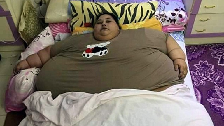 Най-дебелата жена в света не е излизала 25 години от дома си (СНИМКИ)