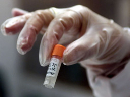 Мъж със симптоми на ебола е хоспитализиран в Прага