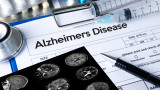 В САЩ одобриха лекарство срещу Алцхаймер