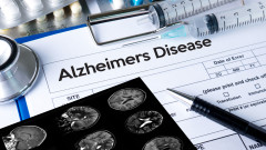 САЩ одобряват първо ново лекарство за Алцхаймер от близо 20 години