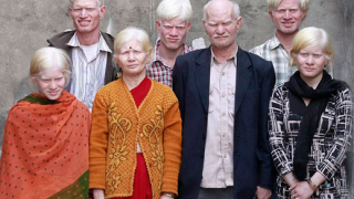 Семейство албиноси влиза в “Гинес”