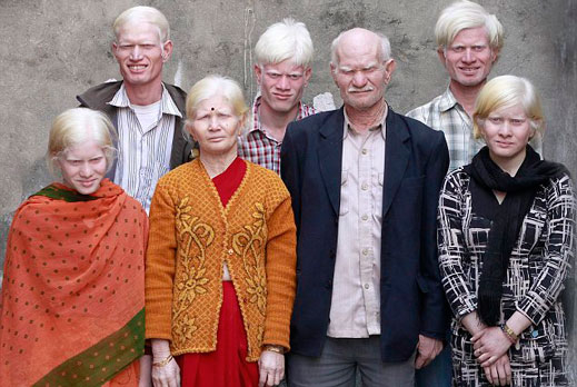 Семейство албиноси влиза в “Гинес”