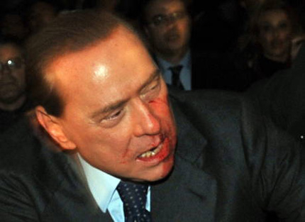 Берлускони ударен в лицето на митинг в Милано