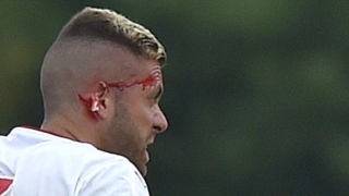 Менес загуби част от ухото си в първия си мач за Бордо
