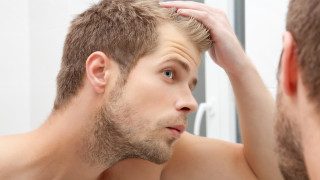 Чували сте че плешивите мъже дължат липсата си на коса