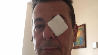 Камен Алипиев си оперира окото